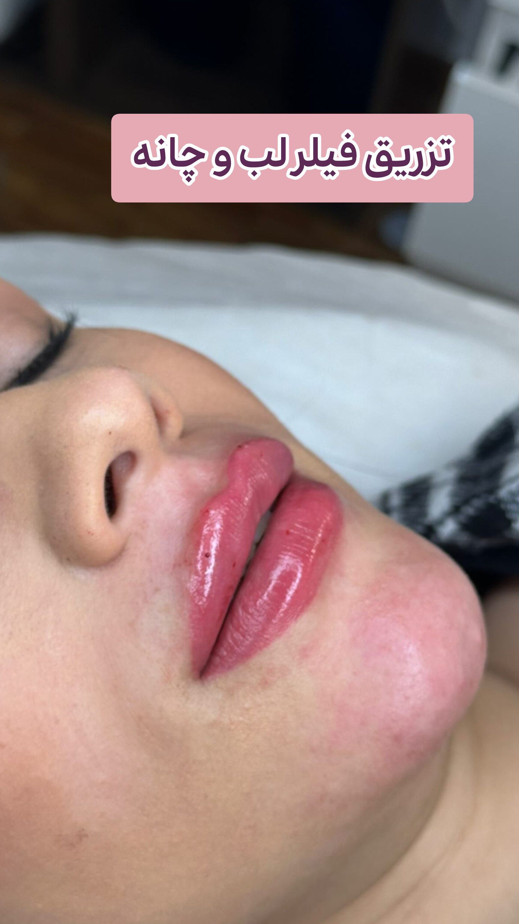 کلینیک تخصصی زیبایی و لیزر موی ابریشم
