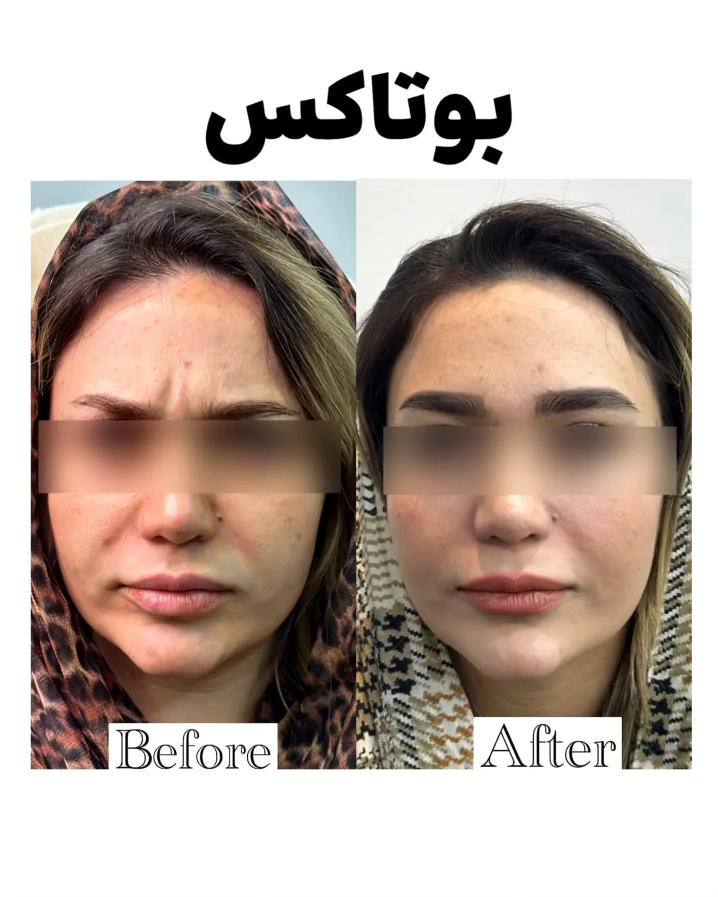 مرکزلیزر و زیبایی نوين اسکین