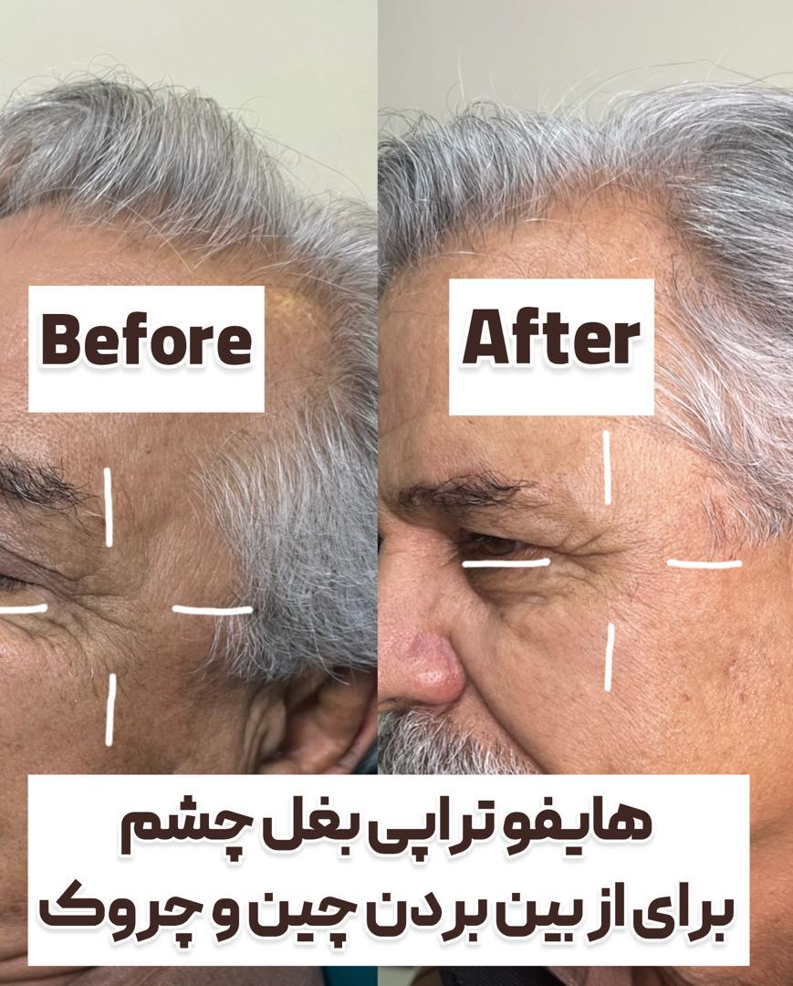 کلینیک زیبایی زرماه