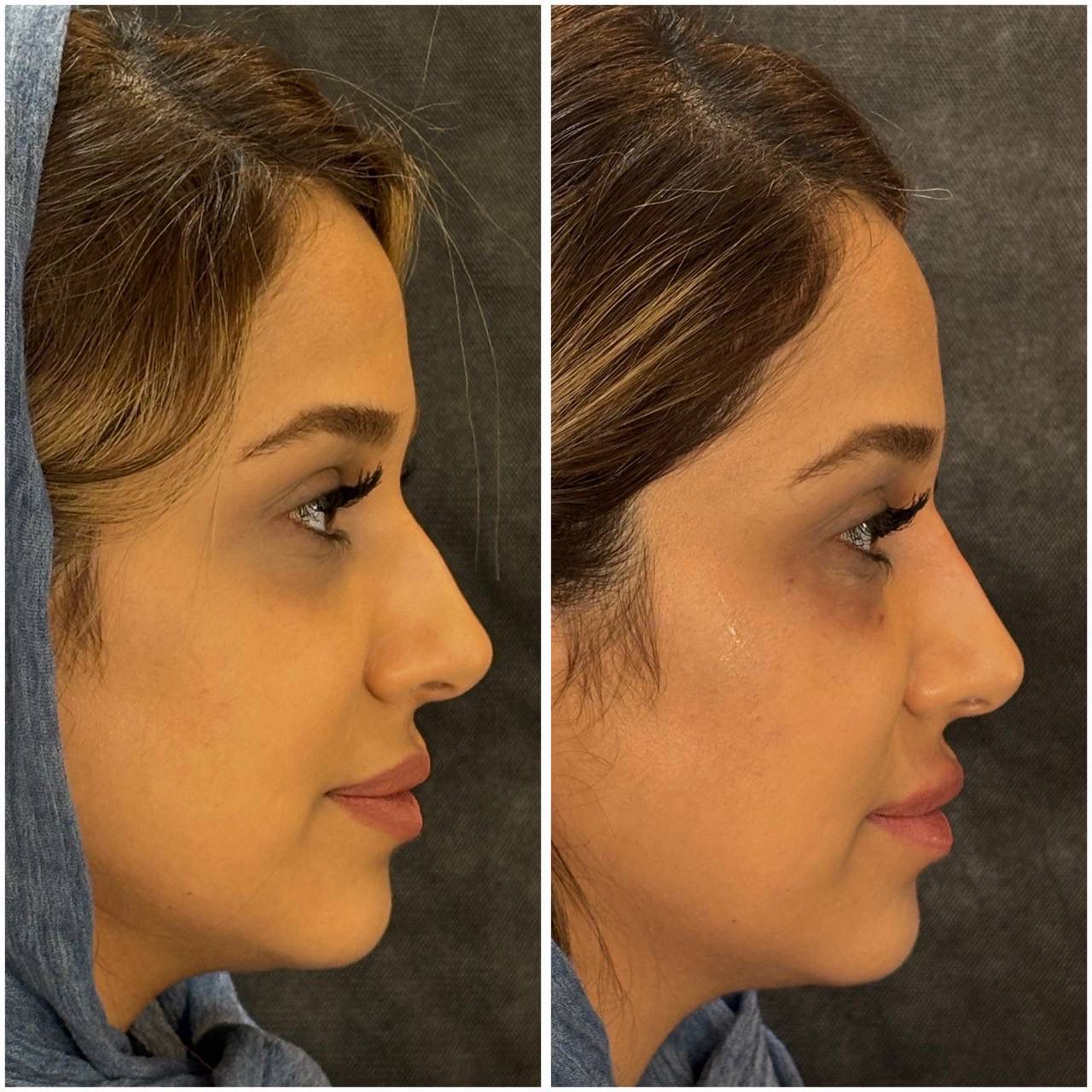 مطب زیبایی لیانارخ