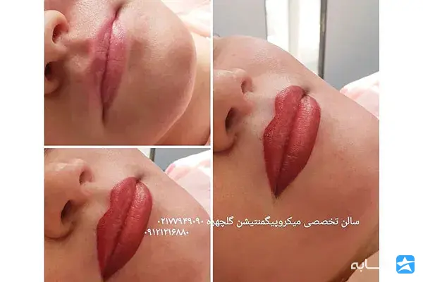 گالری