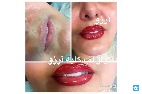 گالری