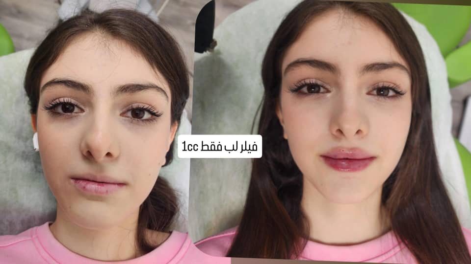 مرکز پوست و مو و لیزر و لاغری آبانا