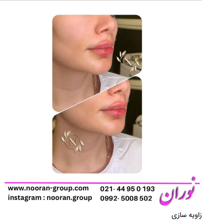 کلینیک زیبایی و مرکز لیزر نوران