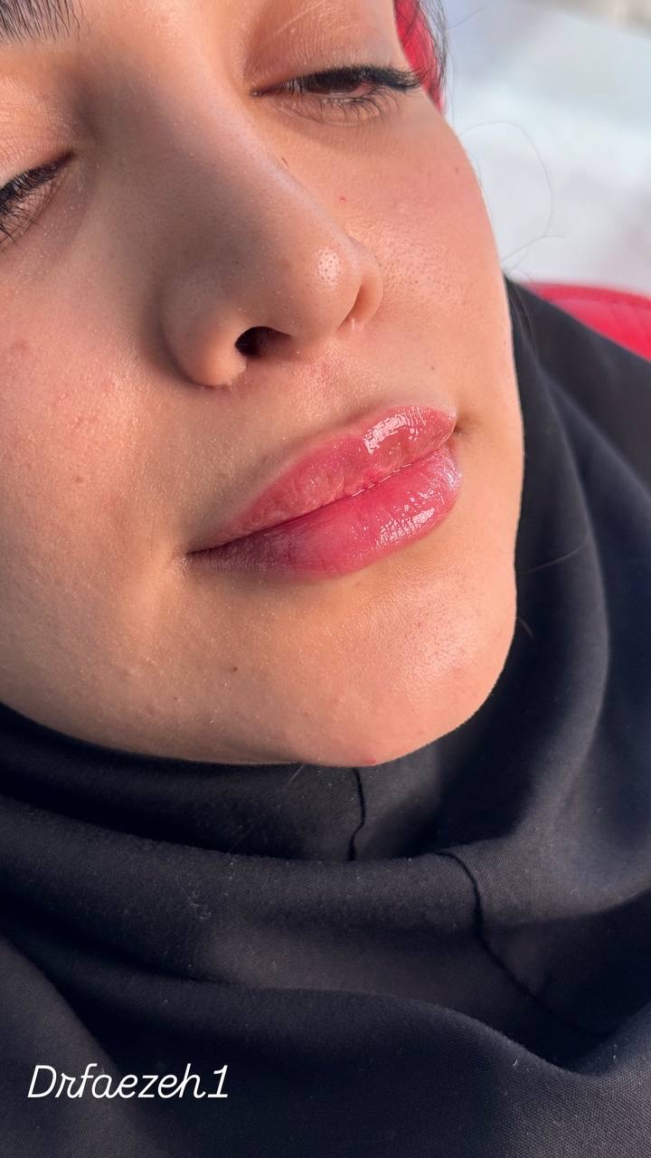 مرکز لیزر و زیبایی نویامِد
