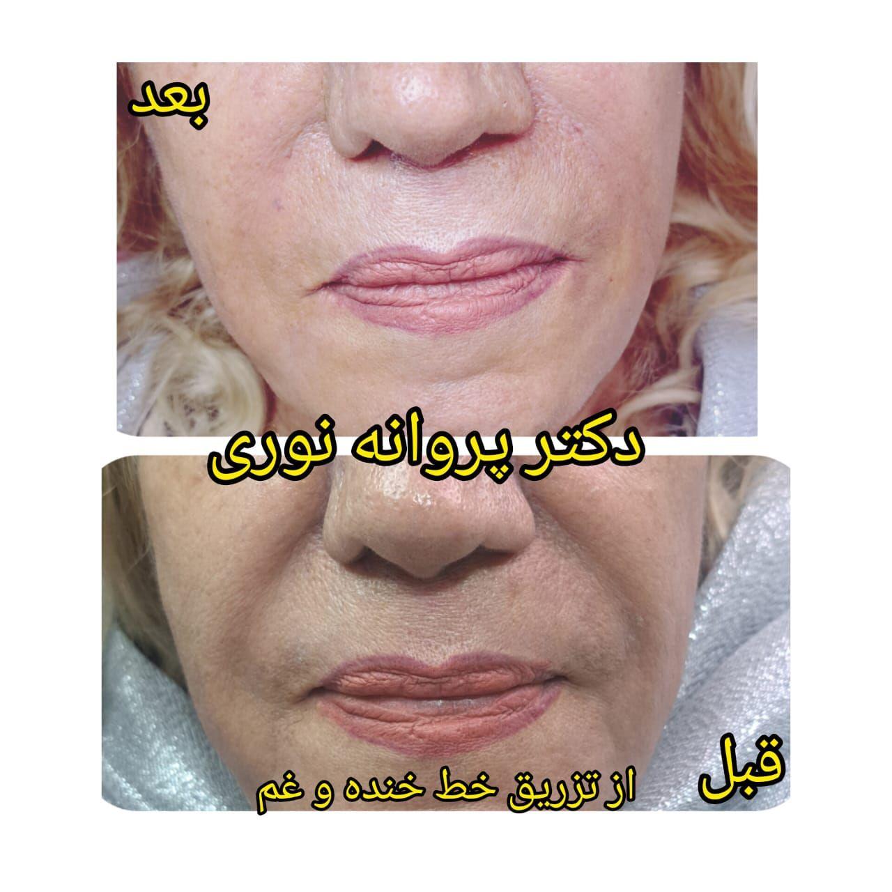کلینیک زیبایی مرکز لیزر دکترپروانه نوری