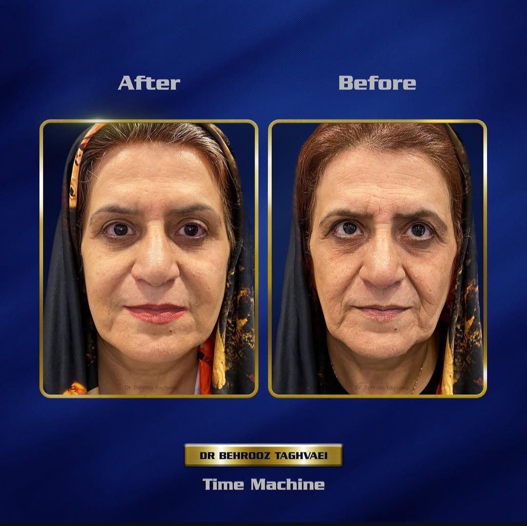 کلینیک زیبایی،مرکز لیزر الکساندرایت تاژا