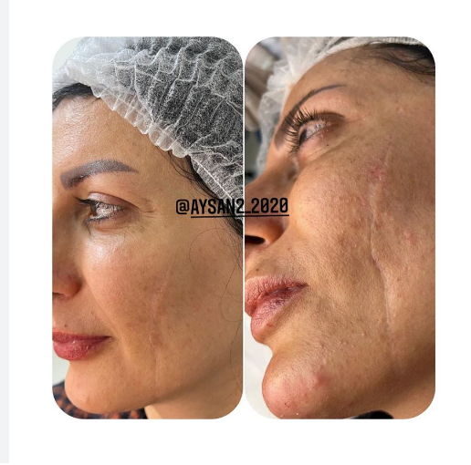 کلینیک پوست مو زیبایی آیسان امیدی وتنم