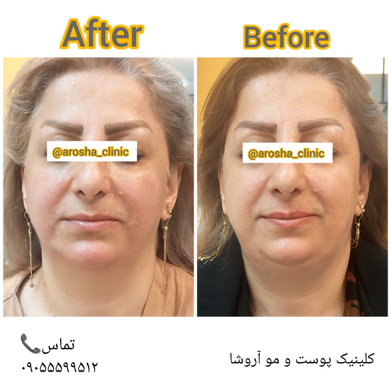 کلینیک پوست ، مو و زیبایی آروشا