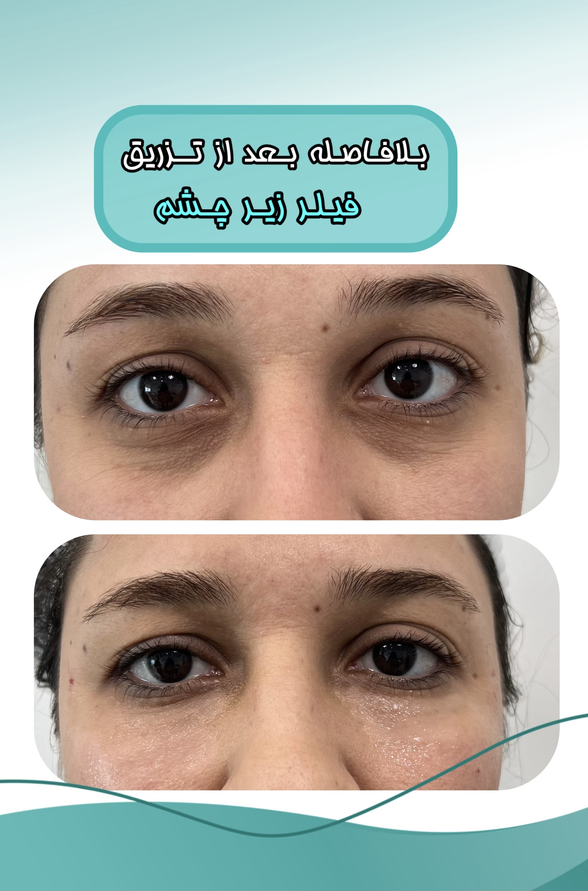 کلینیک پوست،مو و لیزر هانا