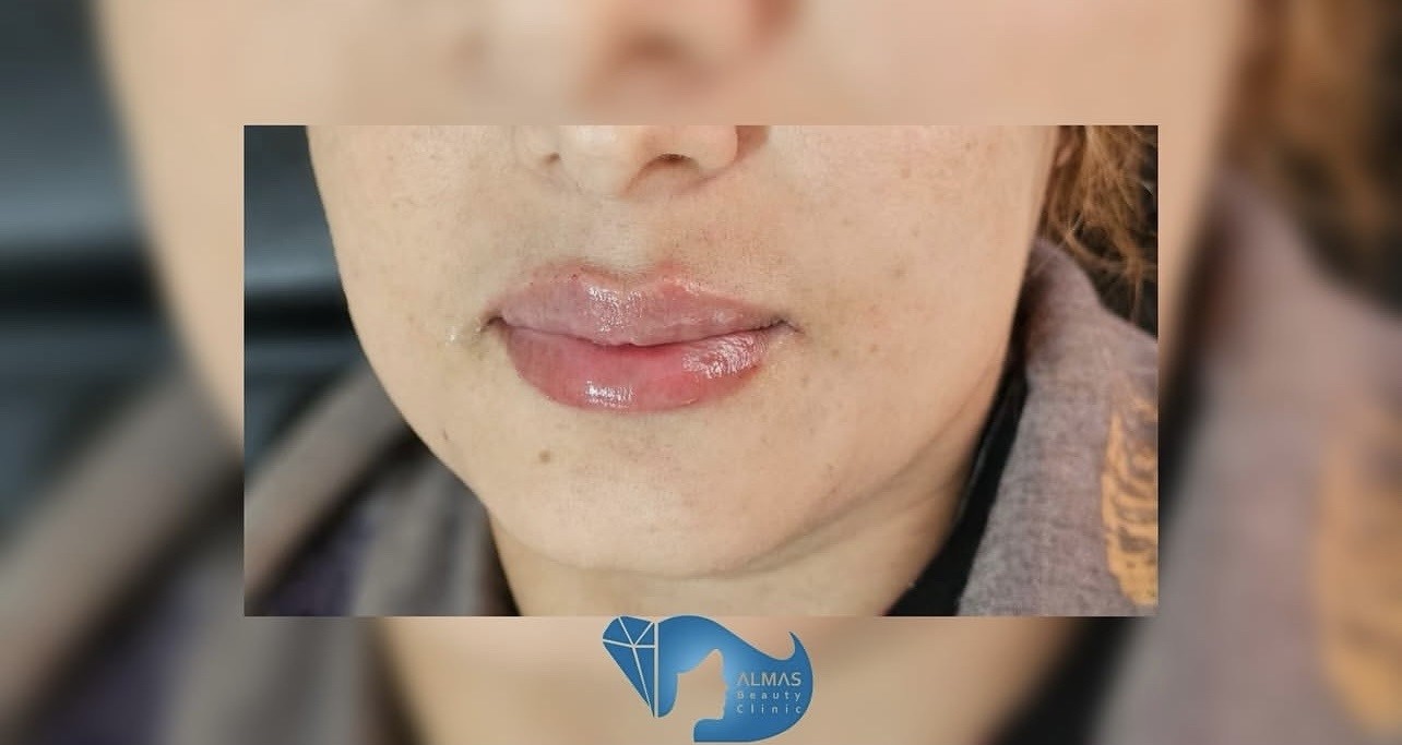 کلینیک پوست، مو، لیزر و زیبایی الماس
