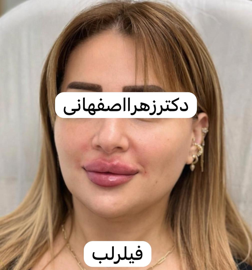 کلینیک پوست مو زیبایی دکتر زهرا اصفهانی