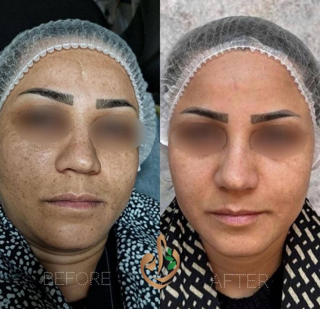 کلینیک پوست مو و لیزر ژاو
