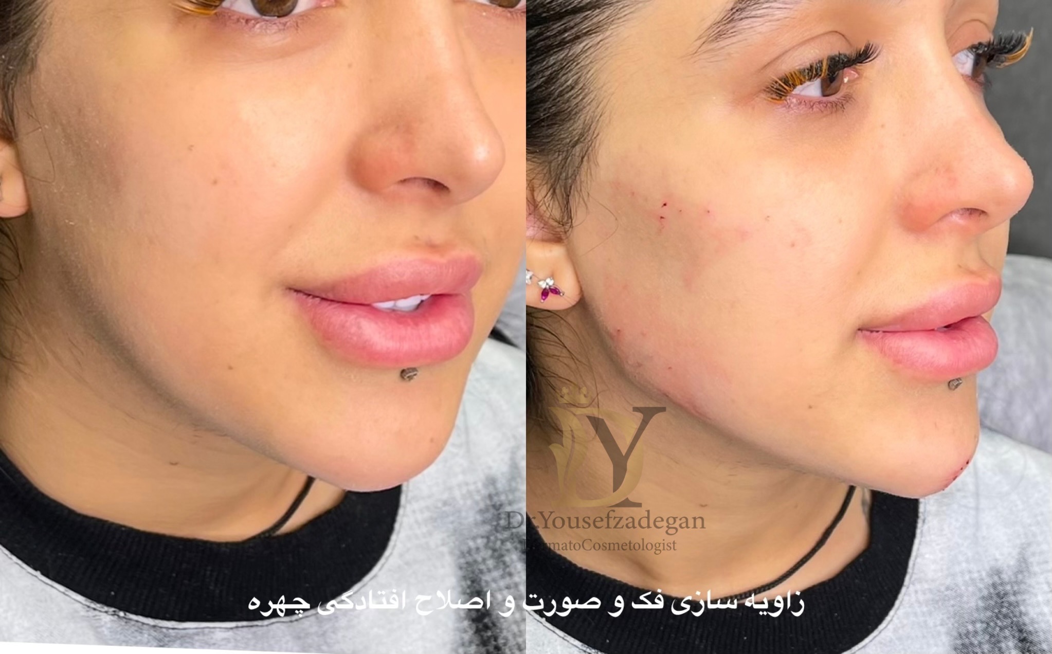 کلینیک زیبایی دکتر یوسف زادگان