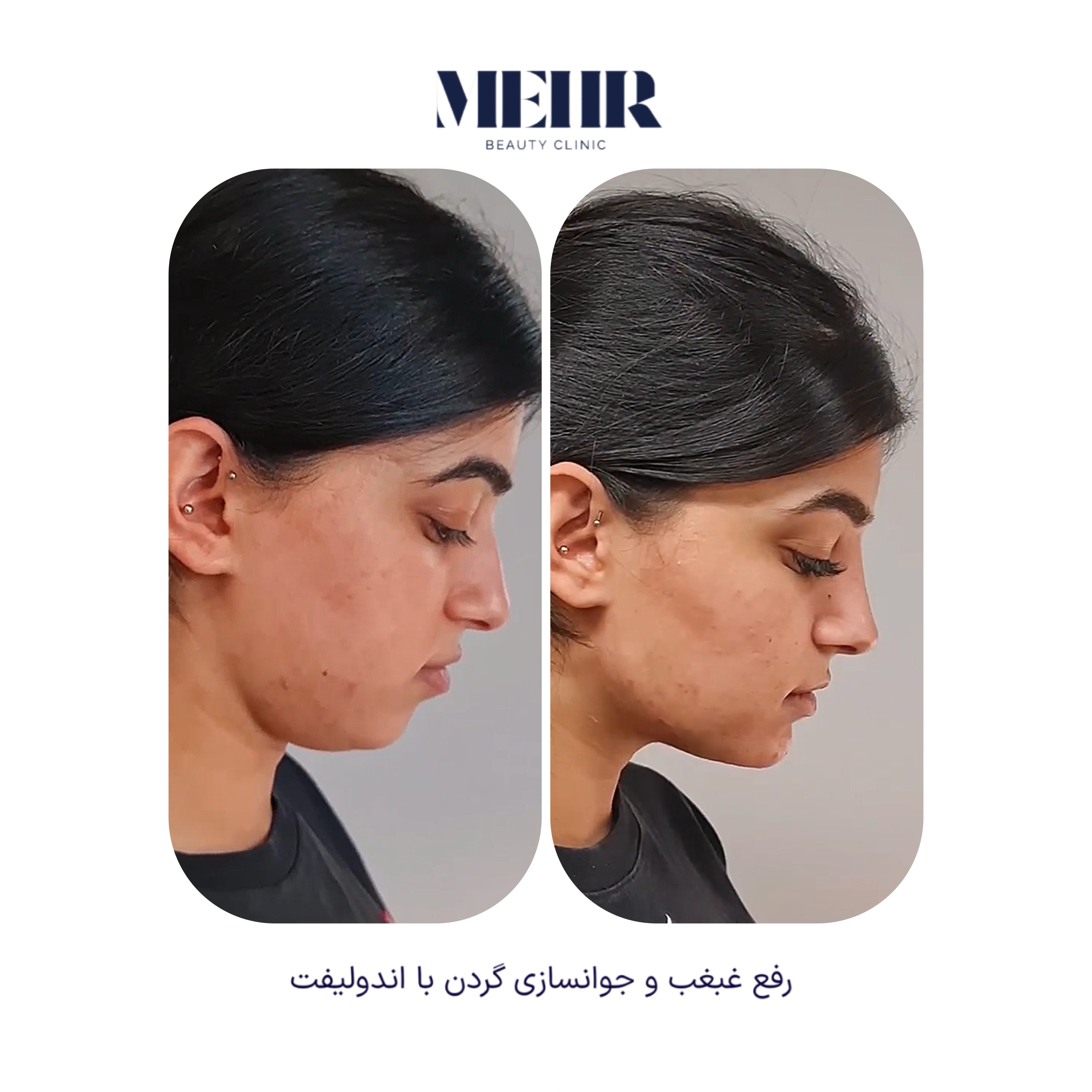 کلینیک زیبایی مهر