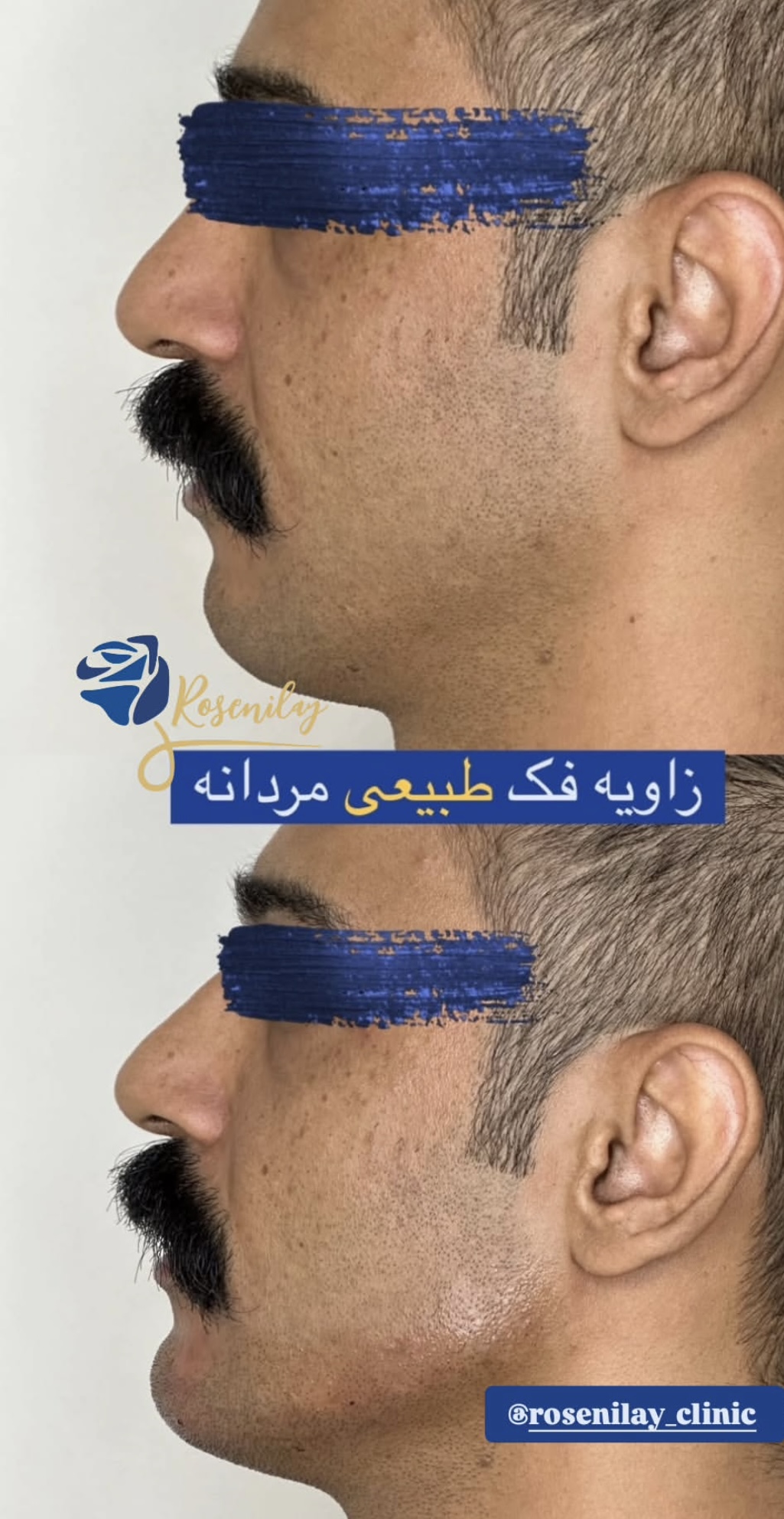 مرکز لیزر کلینیک زیبایی رزنیلای