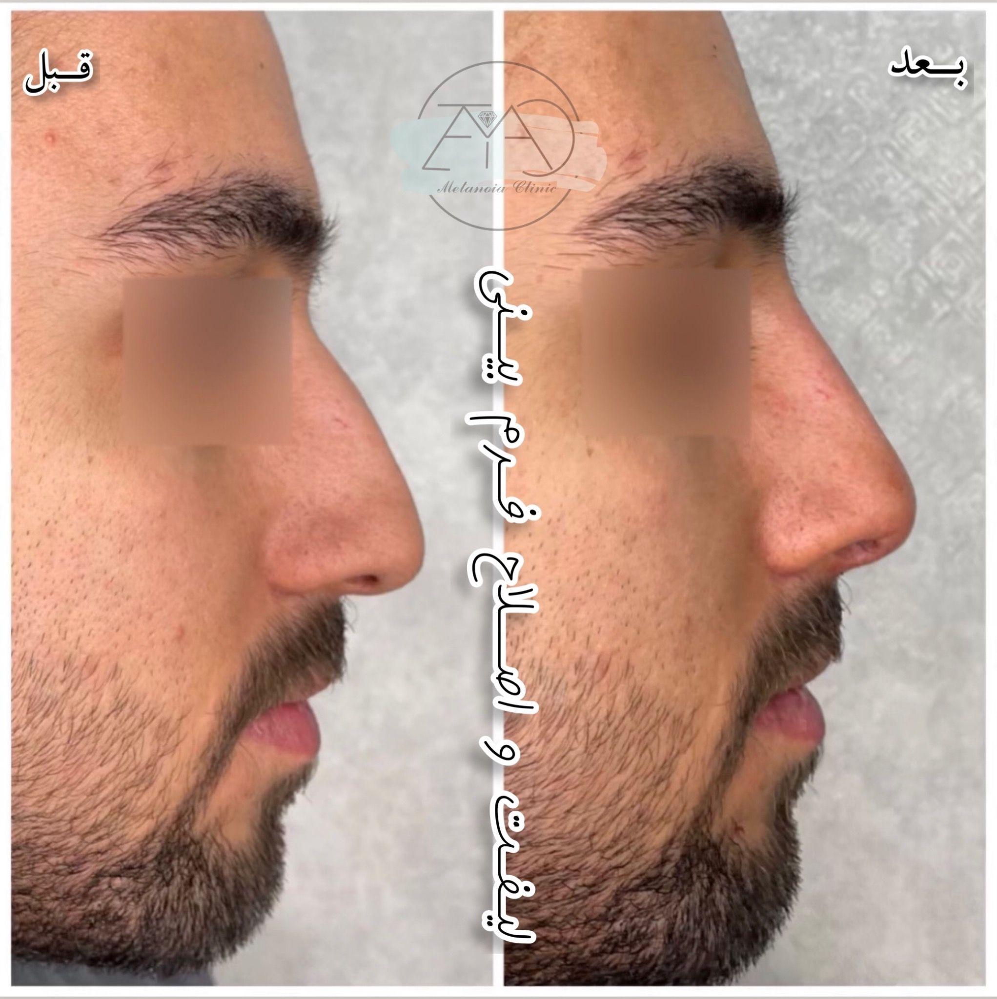 کلینیک زیبایی متانویا