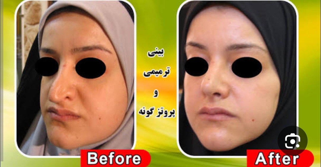 دکتر مهران پیرسحرخیز