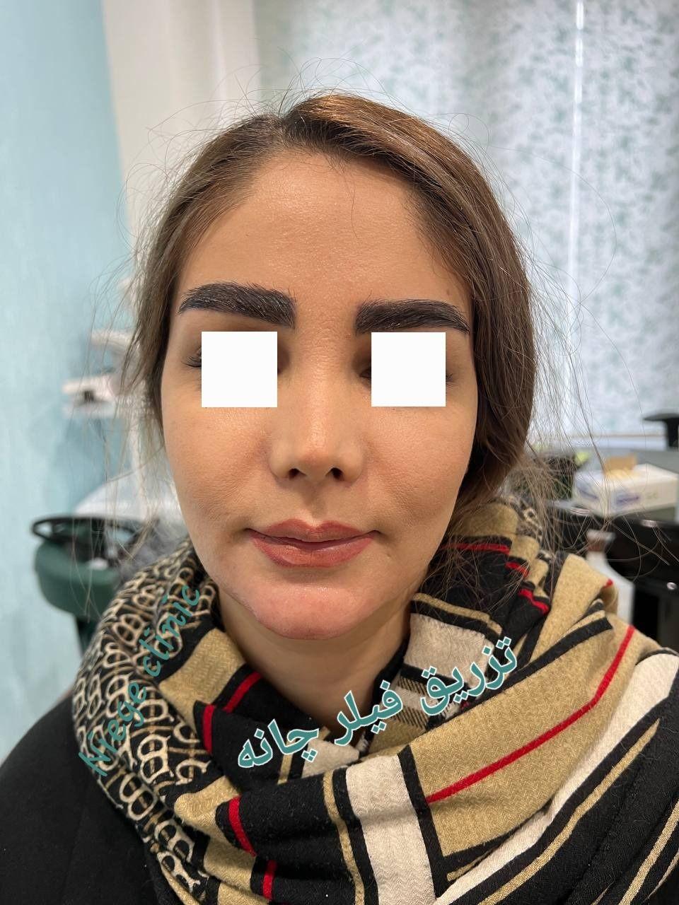 کلینیک پوست مو زیبایی و لیزر نیژ