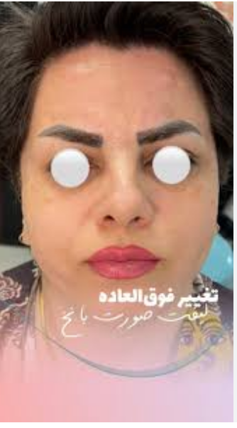 کلینیک زیبایی و مرکز لیزر آیه نقی زاده