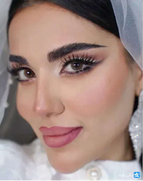 کلینیک زیبایی آرا جنت آباد