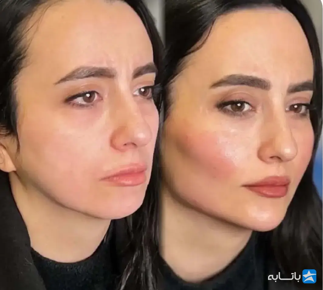 کلینیک زیبایی آتی ماه