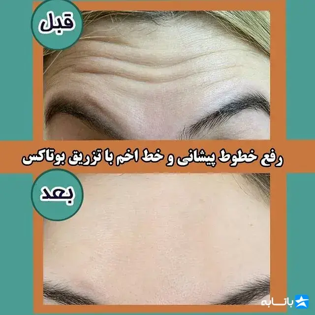کلینیک زیبایی رکسانا بیوتی