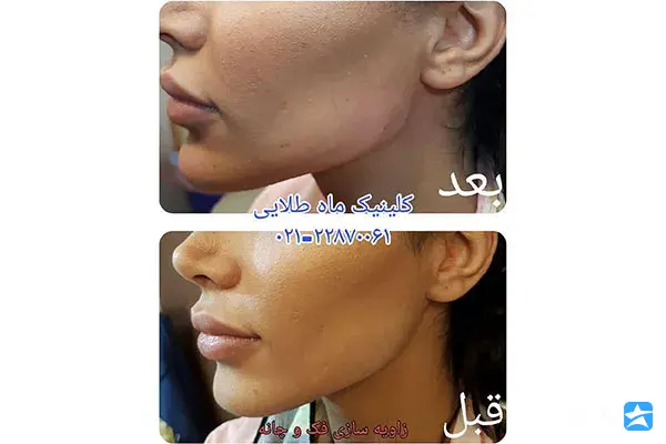 کلینیک زیبایی ماه طلائی